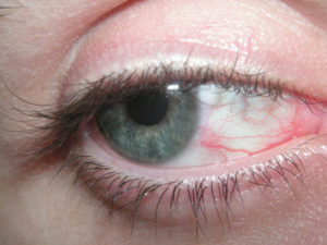 Have Your Eyes Had It?