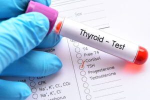 What’s the Hype? Hypothyroidism