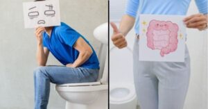 Constipation Concern in People with Intellectual and Developmental Disabilities